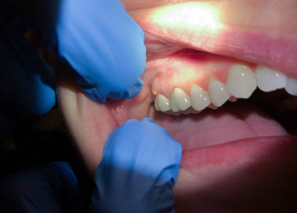 Best Emergency Denture Repair in Vley Grande, AL